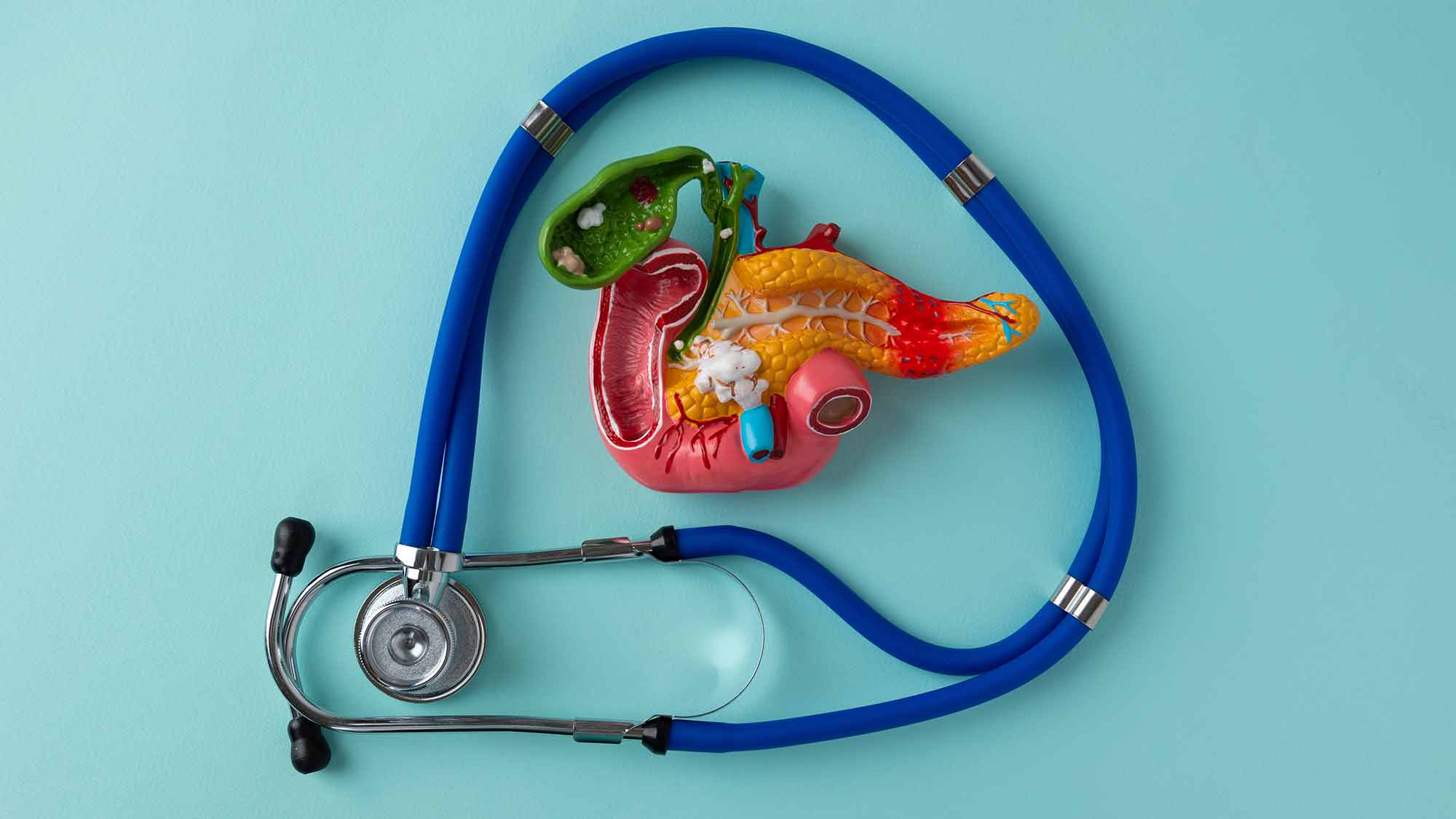 Das Foto zeigt ein Stethoskop und das 3D-Modell einer Gallenblase.