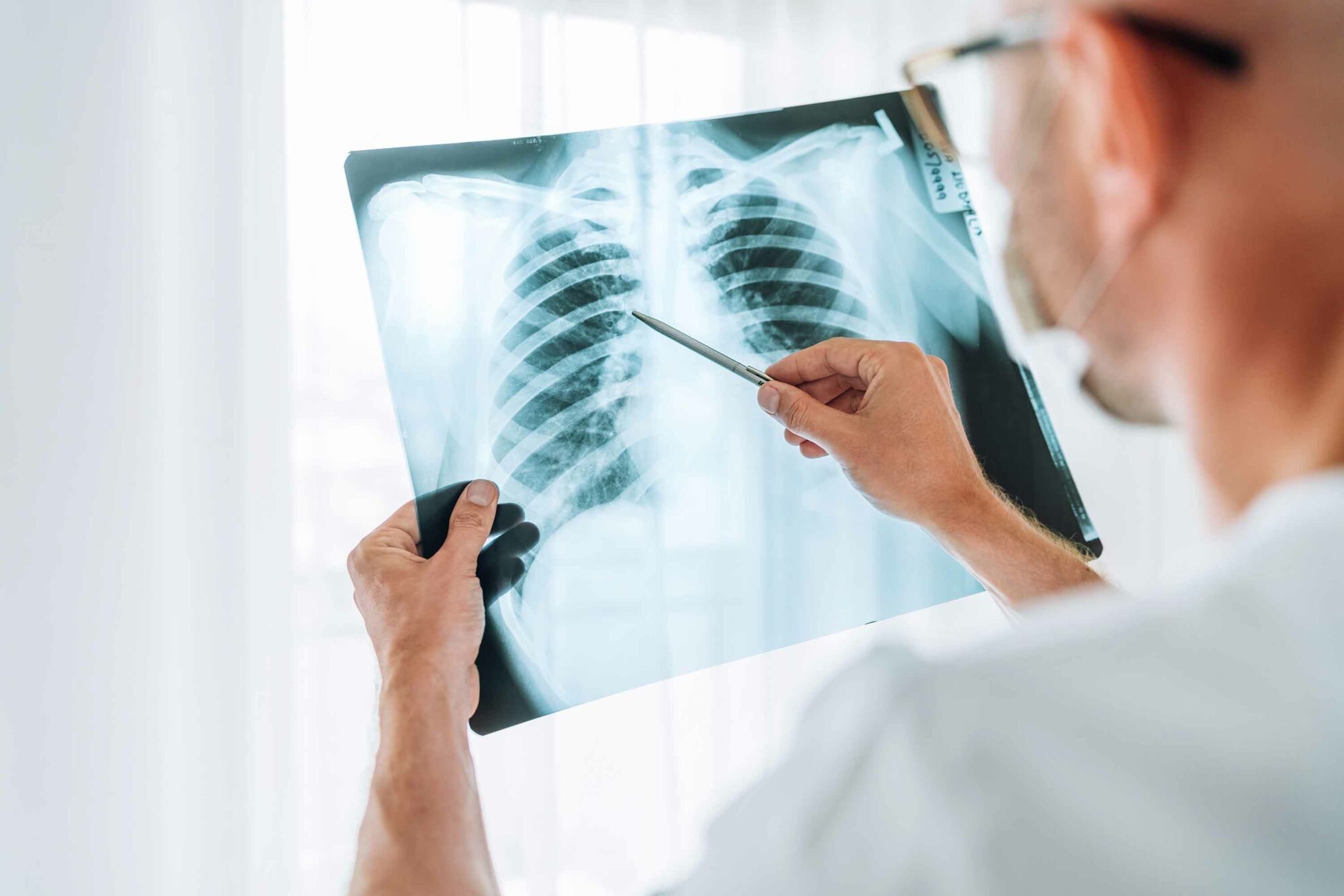 Das Foto zeigt einen Arzt, der sich das Röntgenbild einer Patientin oder eine Patienten anschaut.